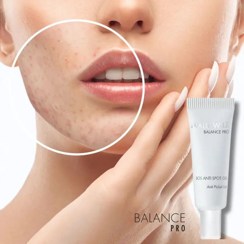 SOS ANTI SPOT GEL | SOS ANTI SPOT GEL
